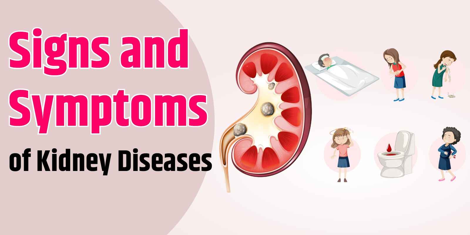 Signs and Symptoms of Kidney Diseases